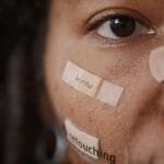 alt="Rostro de mujer, media cara con varios parches colocados en sus mejillas y nariz"