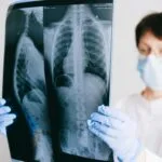 alt="Doctora con mascarilla y guates observando radiologia en placa acerca de un cuerpo completo"