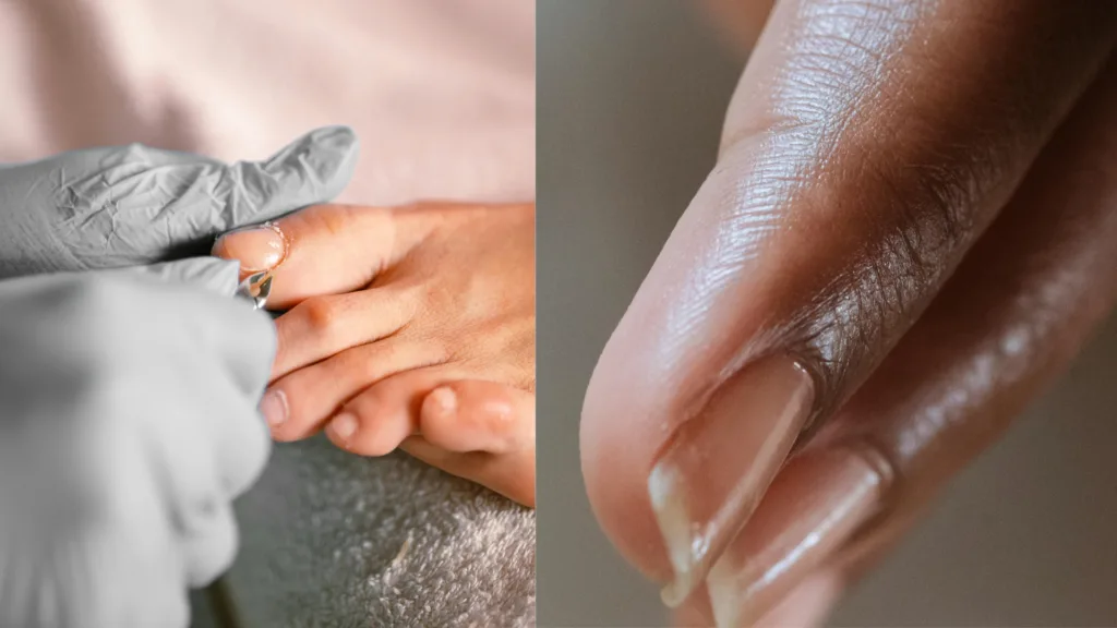 alt="en el lado izquierdo de la imagen se ve un pie derecho recibiendo tratamiento de limpieza, manos con guates de color gris, del otro lado se ven unos dedos con uñas arregladas en perfectas condiciones, dedods inclinados hacia abajo"